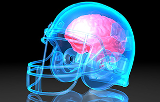 Concussions pose silent risks to university and pro athletes